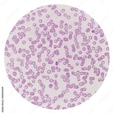  Babesia! A Tiny Terror Lurking Within the Bloodstream