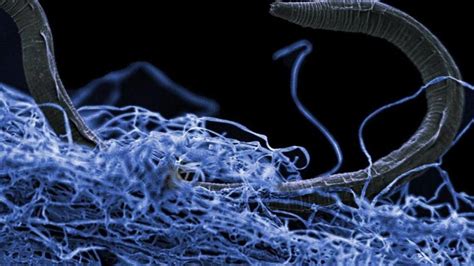  Konotrichia:  A Mysterious Microbe Lurking Beneath Your Feet?