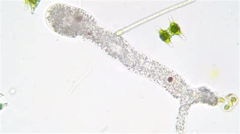  Leptomyxa! An Amoeboid Enigma With Tentacular Pseudopodia Exploring the Microscopic World