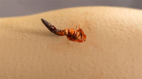  Quisplingus: A Tiny Terror with Legs for Days that Crawls Under Your Skin